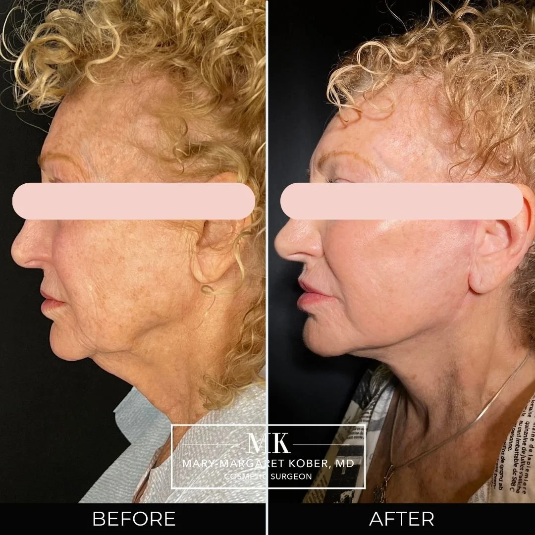Jack Zamora MD Cosmetic Surgery and Aesthetics - Facelift & Neck